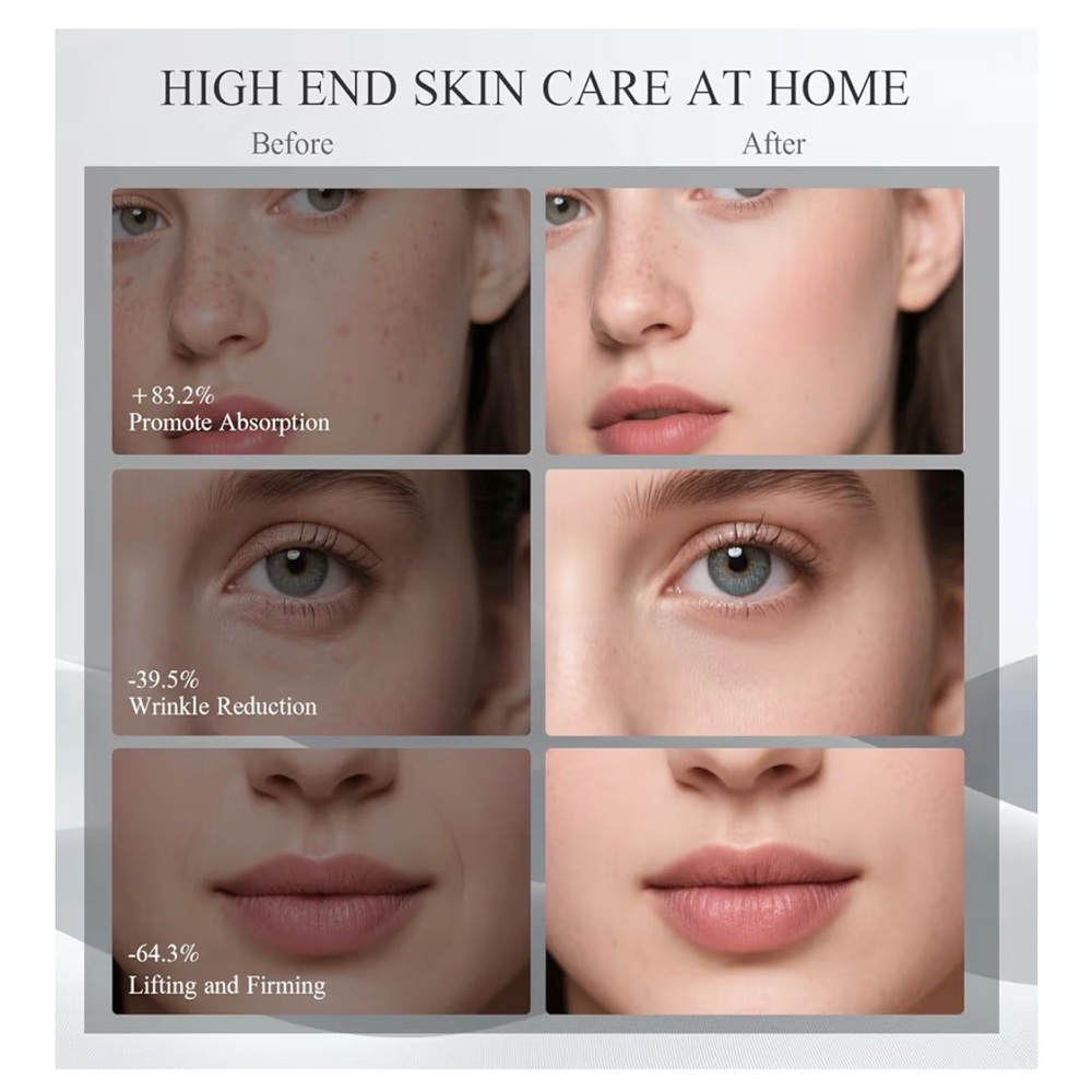 Facial Lift Device - Picture 4 of 7